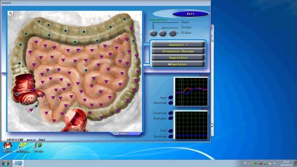 3d nls health analyzer software 3