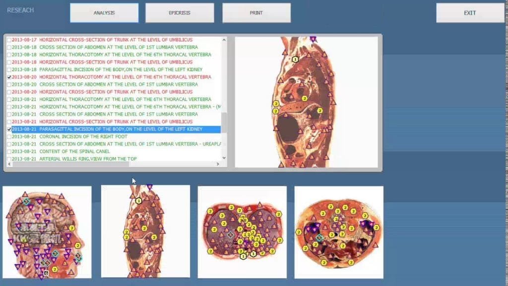 Everything You Need to Know About bioplasm nls health analyzer 7 3d nls plus software 21