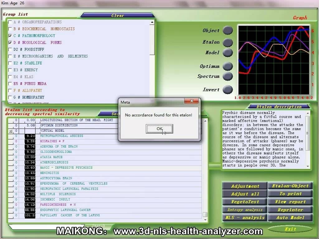 best price biofeedback health analyzer 3d nls manufacturers in USA 7 3d nls