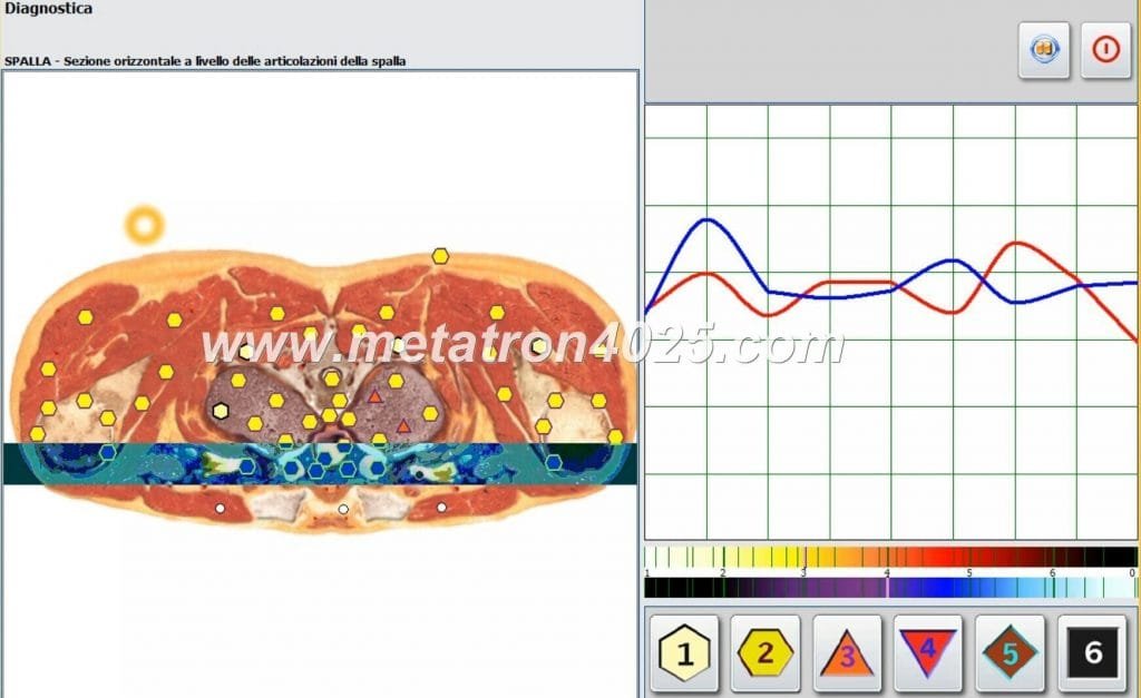 Metatron 4025 Hunter Preis Where To Get? 6 metatron 4025 hunter preis