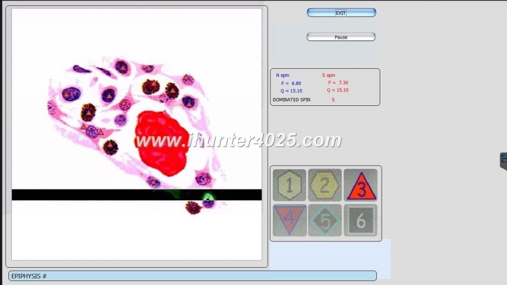oberon diagnostic machine price
