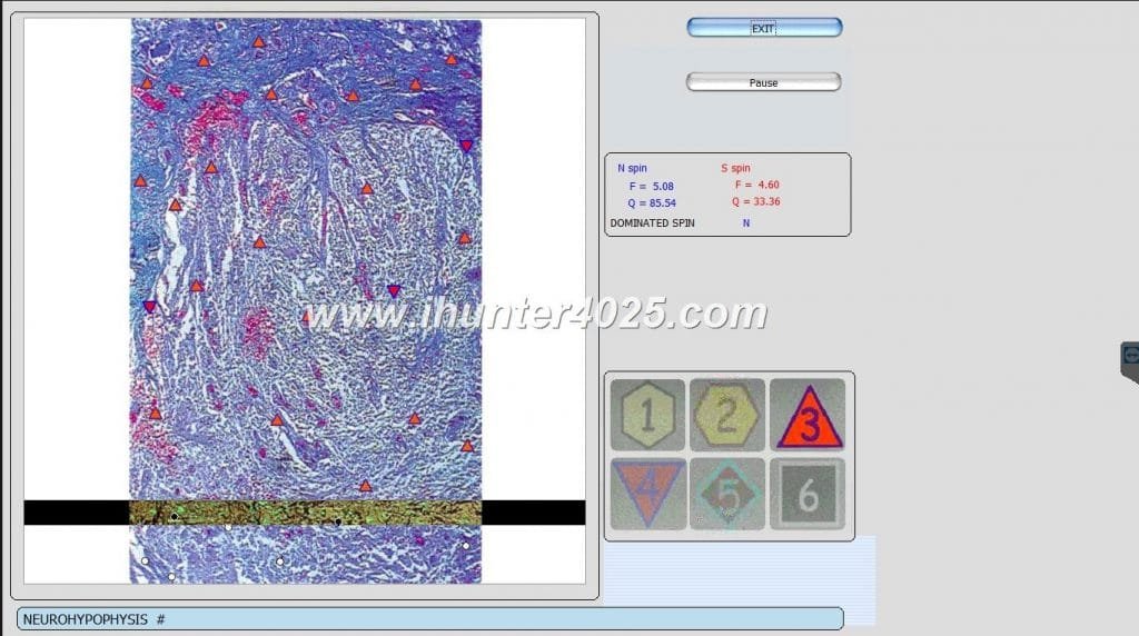 oberon diagnostic machine price