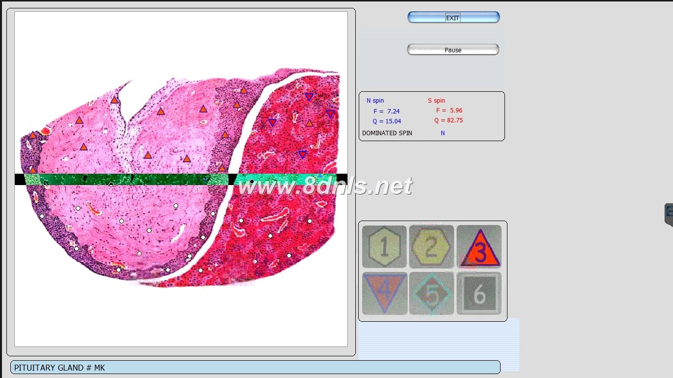 Hunter Metatron Device: Expert Guide to Advanced Bioresonance Diagnostics & Therapy 14 Hunter Metatron Device 12