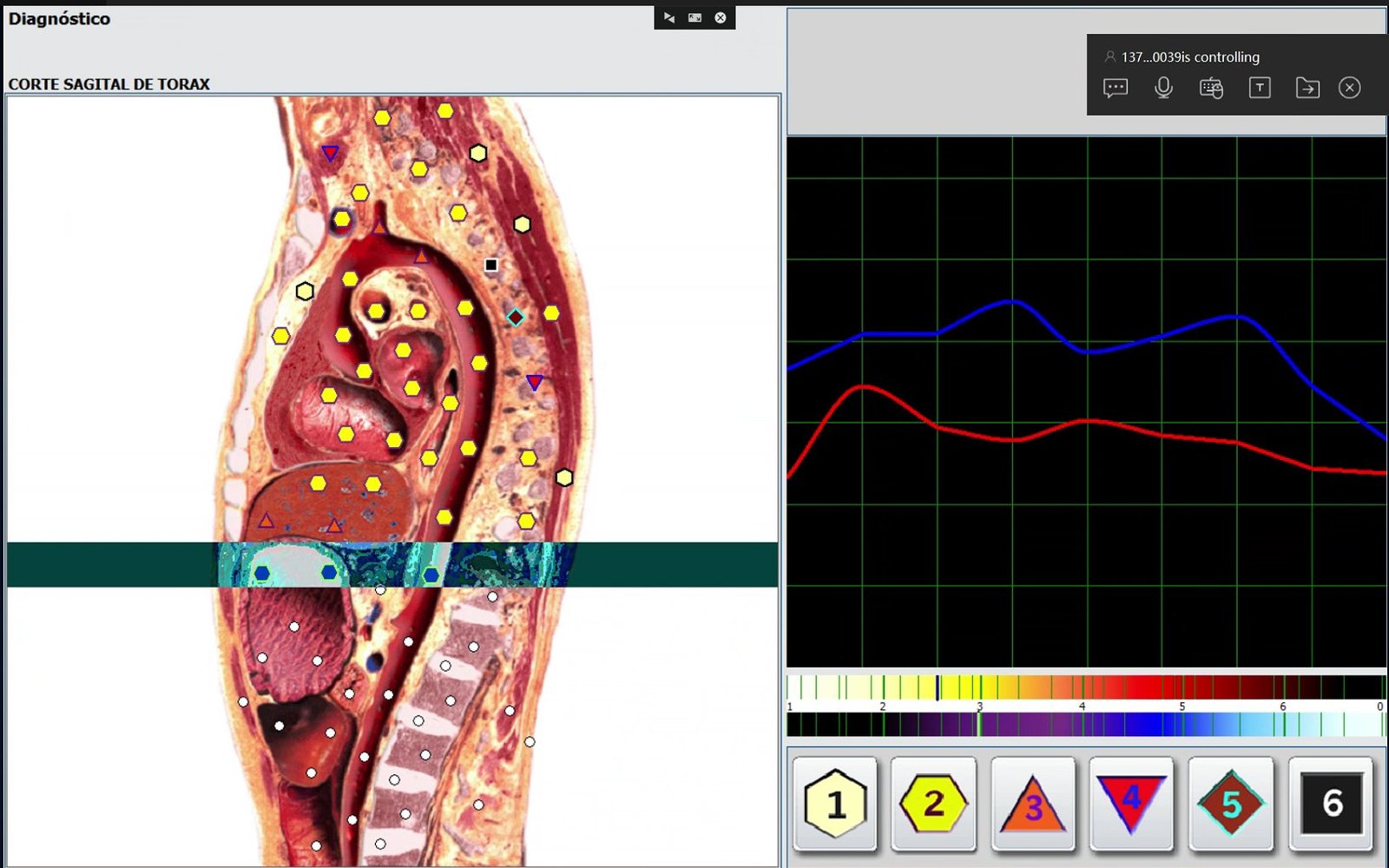 Healthcare practitioners using Hunter 4025