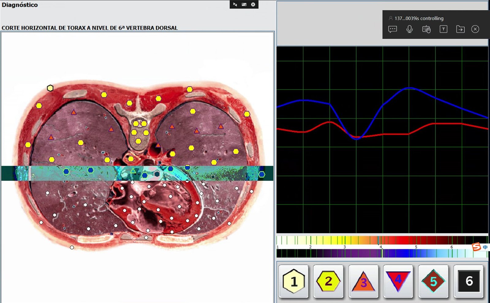 Pathogen detection interface