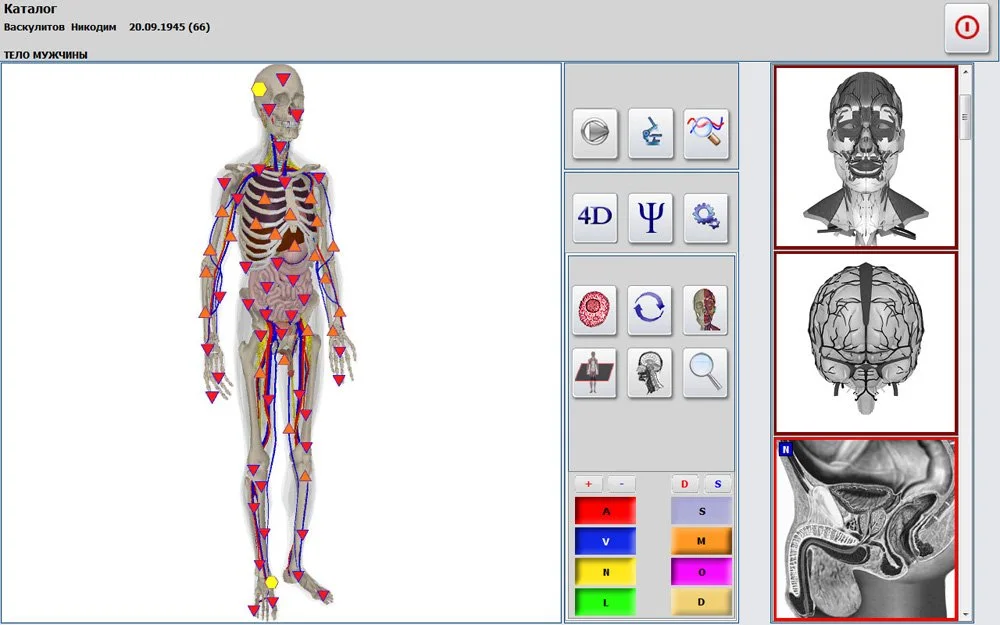 Meta Hunter NLS Diagnostics: Practical Guide for U.S. Wellness Centers — MAIKONG Hunter 4025 Metatron (5252).jpg
