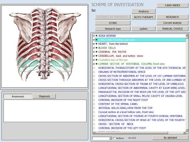Can a Metatron system be used in a U.S. hospital? Practical guidance for clinical leaders 2 Hunter 4025 NLS Health Analyzer: What a U.S. Wellness Center Actually Gets — MAIKONG Hunter 4025 Metatron (737).JPG