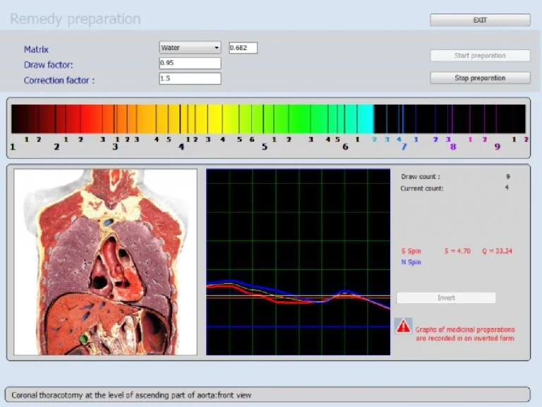 NLS Analyzer System: Practical Guidance for U.S. Wellness Entrepreneurs 5 NLS Analyzer System: Practical Guidance for U.S. Wellness Entrepreneurs — MAIKONG Hunter 4025 Metatron (588).jpg