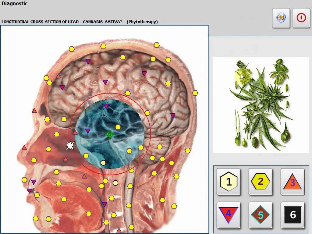 What U.S. Alternative Wellness Practitioners Should Know When Searching for an Oberon Diagnostic Machine for Sale 1 What U.S. Alternative Wellness Practitioners Should Know When Searching for an Oberon Diagnostic Machine for Sale — MAIKONG Hunter 4025 Metatron (4497).jpg