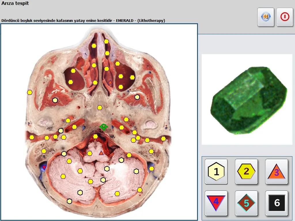 Can the Biophilia Meta Hunter Bioresonance Machine (Chakra Version) Serve U.S. Functional Wellness Practices? — MAIKONG Hunter 4025 Metatron (4961).jpg