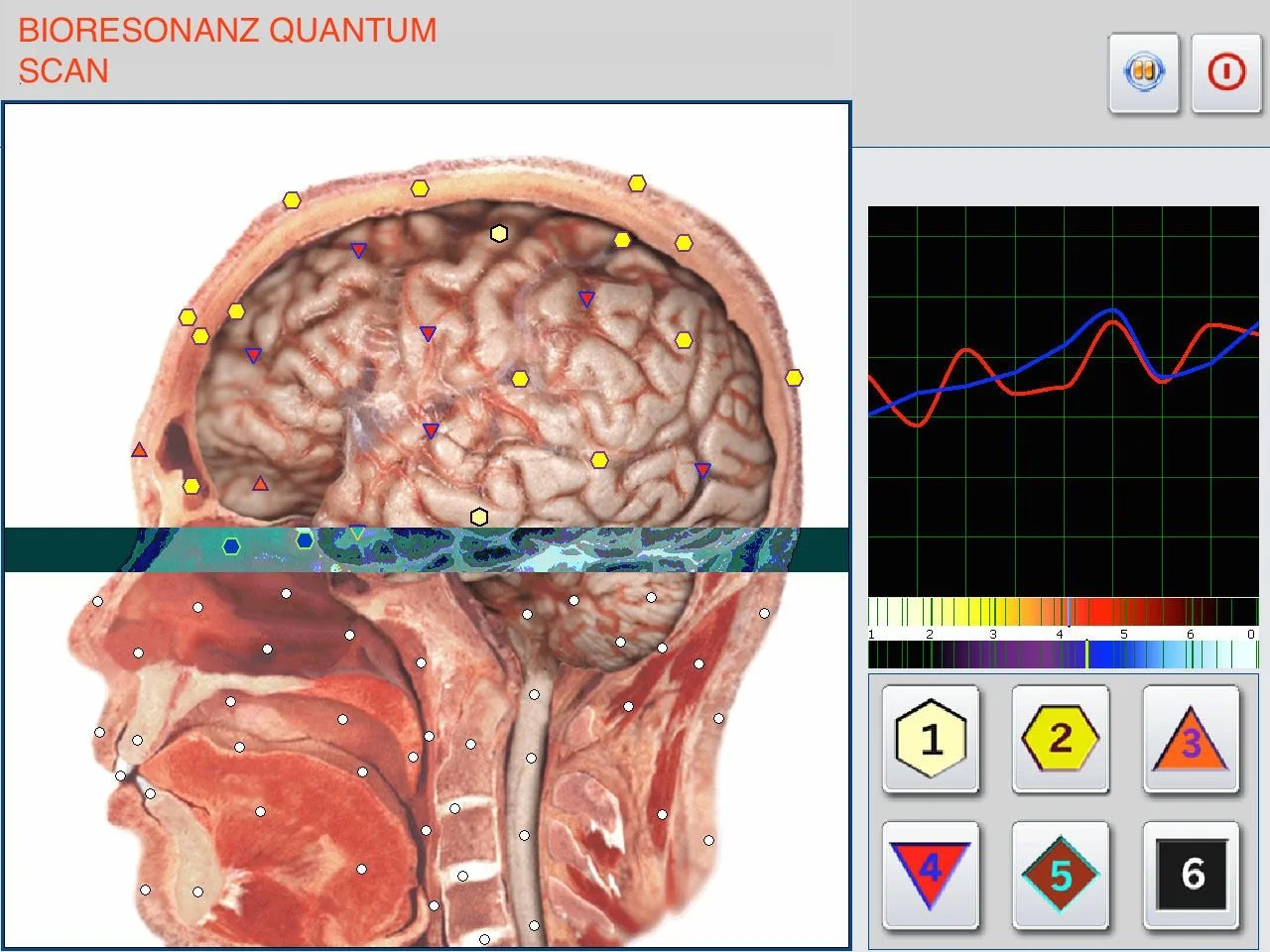 Can the Biophilia Meta Hunter Bioresonance Machine (Chakra Version) Serve U.S. Functional Wellness Practices? — MAIKONG Hunter 4025 Metatron (5163).jpg