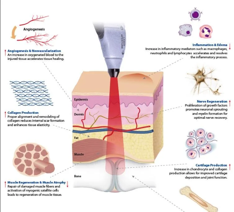 Suyzeko Low Level Laser Therapy Watch — What U.S. Health Coaches Need to Know 3 Suyzeko Low Level Laser Therapy Watch — What U.S. Health Coaches Need to Know — does low level laser therapy work.JPG